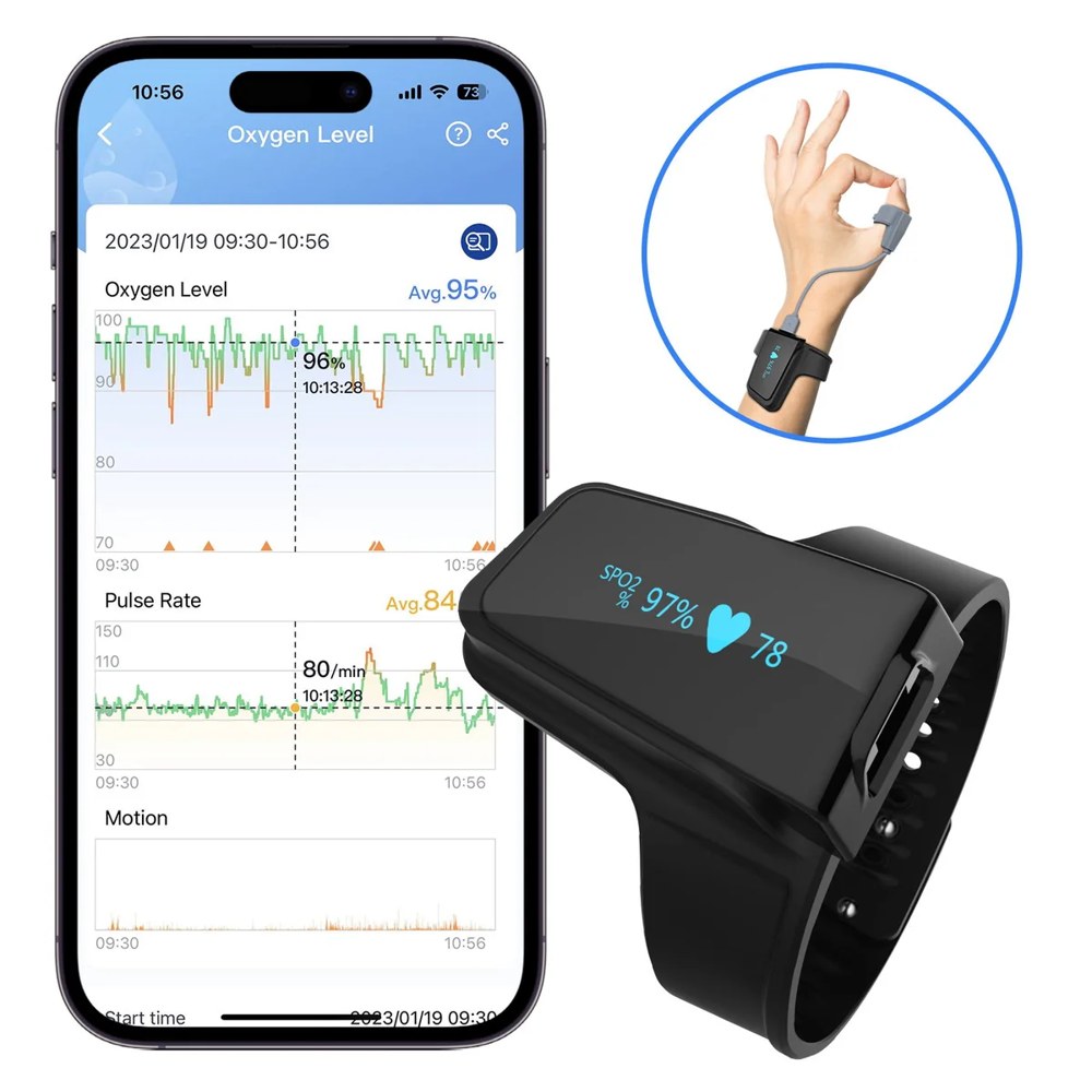 Wellue Checkme O2 Max